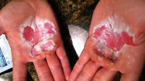 I wasn't aware this was part of fitness...